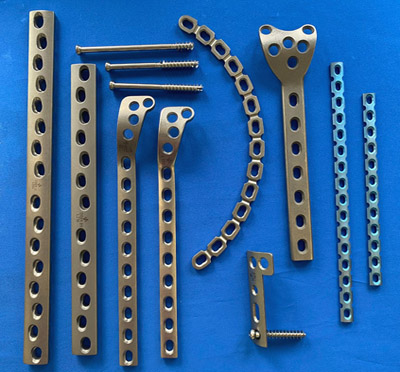 Остеосинтез